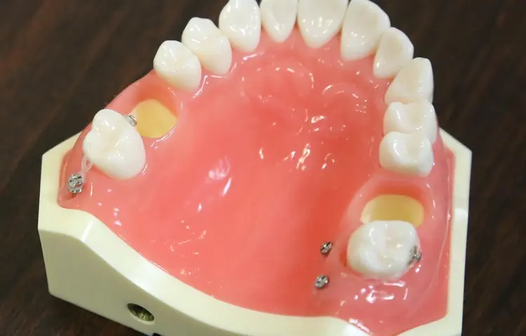 ミニスクリューインプラント